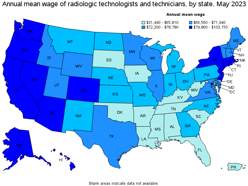 Map of annual mean wages of radiologic technologists and technicians by state, May 2021